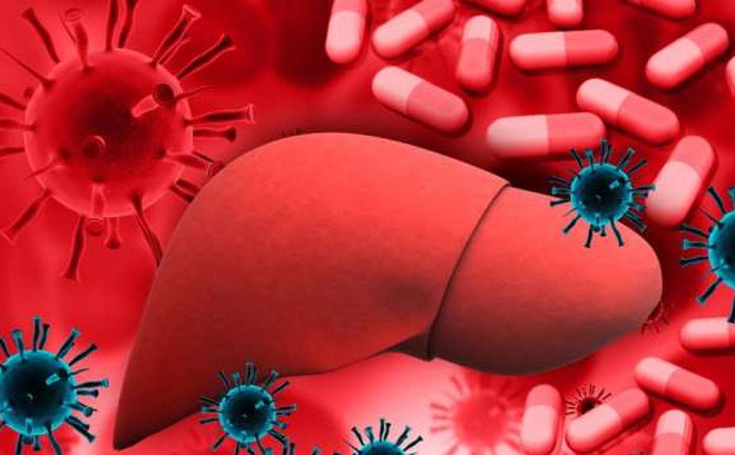 Xơ gan không do rượu - Hình ảnh minh họa